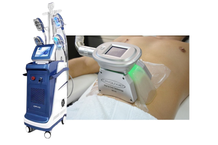 Machine de cryolipolyse en cabine