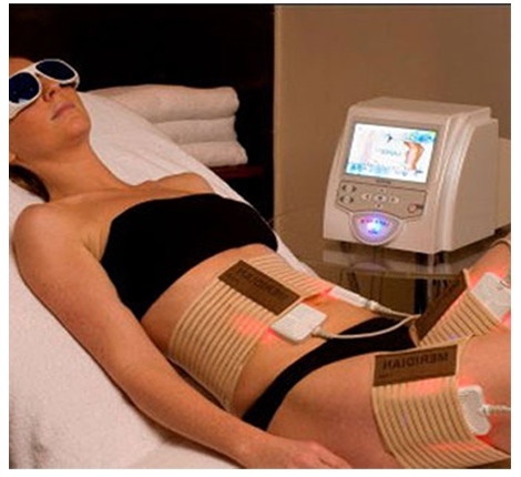 Traitement Lipo Laser avec appareil LAPEX